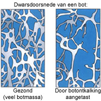 dwarsdoorsnede bot